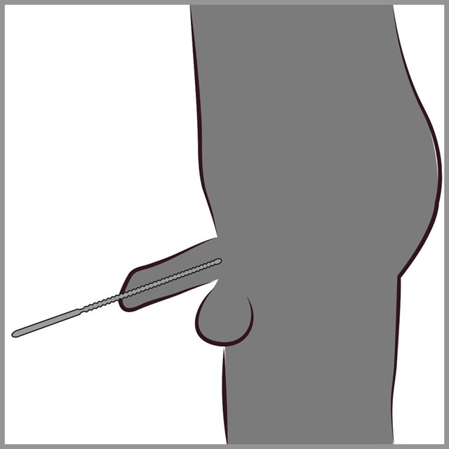 Ribbed Dilator 24 cm
