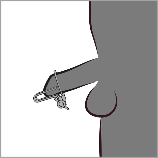 Urethral Stretcher