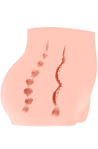 Kokos Cherry Masturbator 3kg